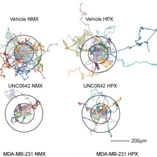 cell motility hypoxia cancer reserach live cell imaging