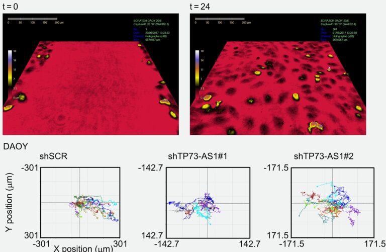 lncRNA cancer research cancer reserach live cell imaging