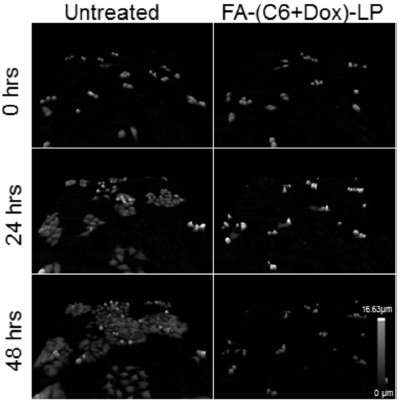 drug discovery live cell imaging