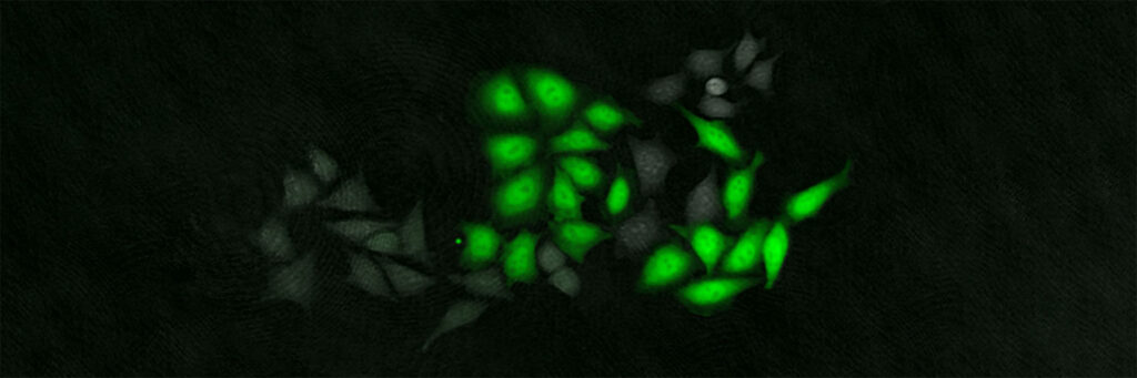Green fluorescent cells on a black background.